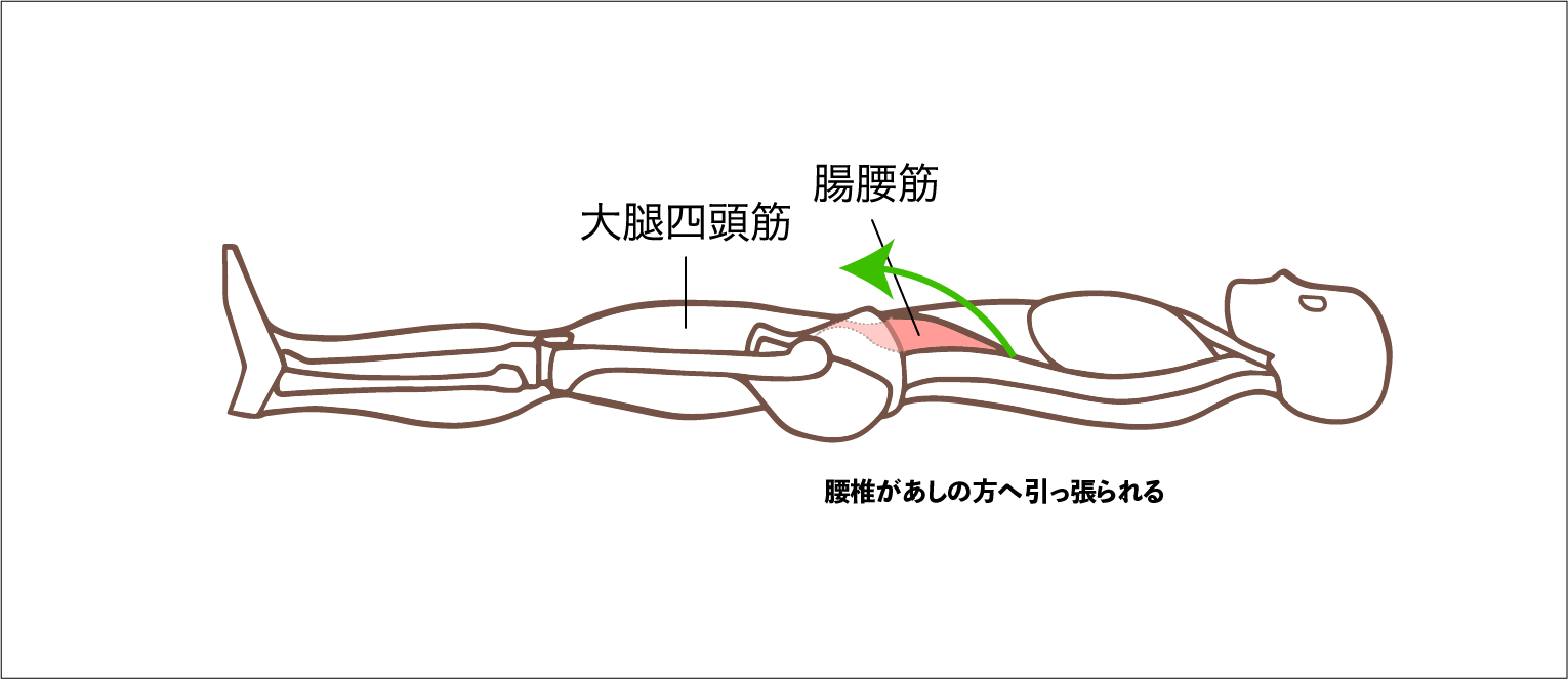腸腰筋の位置図。骨盤を跨いて骨と大腿骨を繋いでいることが分かる。